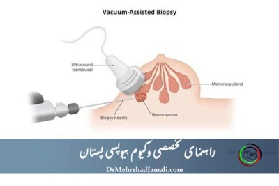 مرکز تخصصی وکیوم بیوپسی