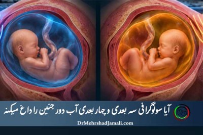 سونوگرافی سه بعدی و چهار بعدی در بارداری؛ بی‌خطر یا خطرناک؟